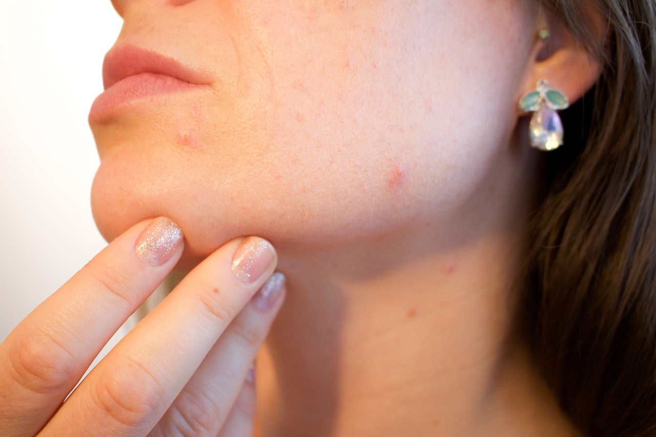 Understanding dermatology and how to care for your skin.